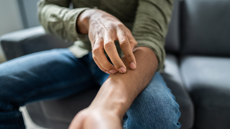 A man scratching rash 