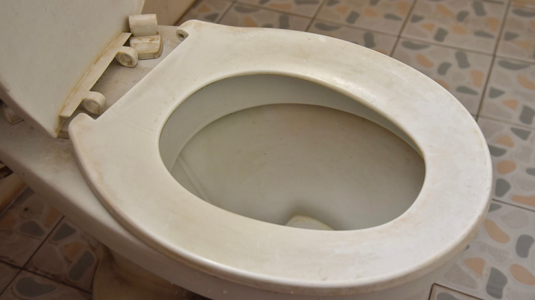 Dirty toilet seat