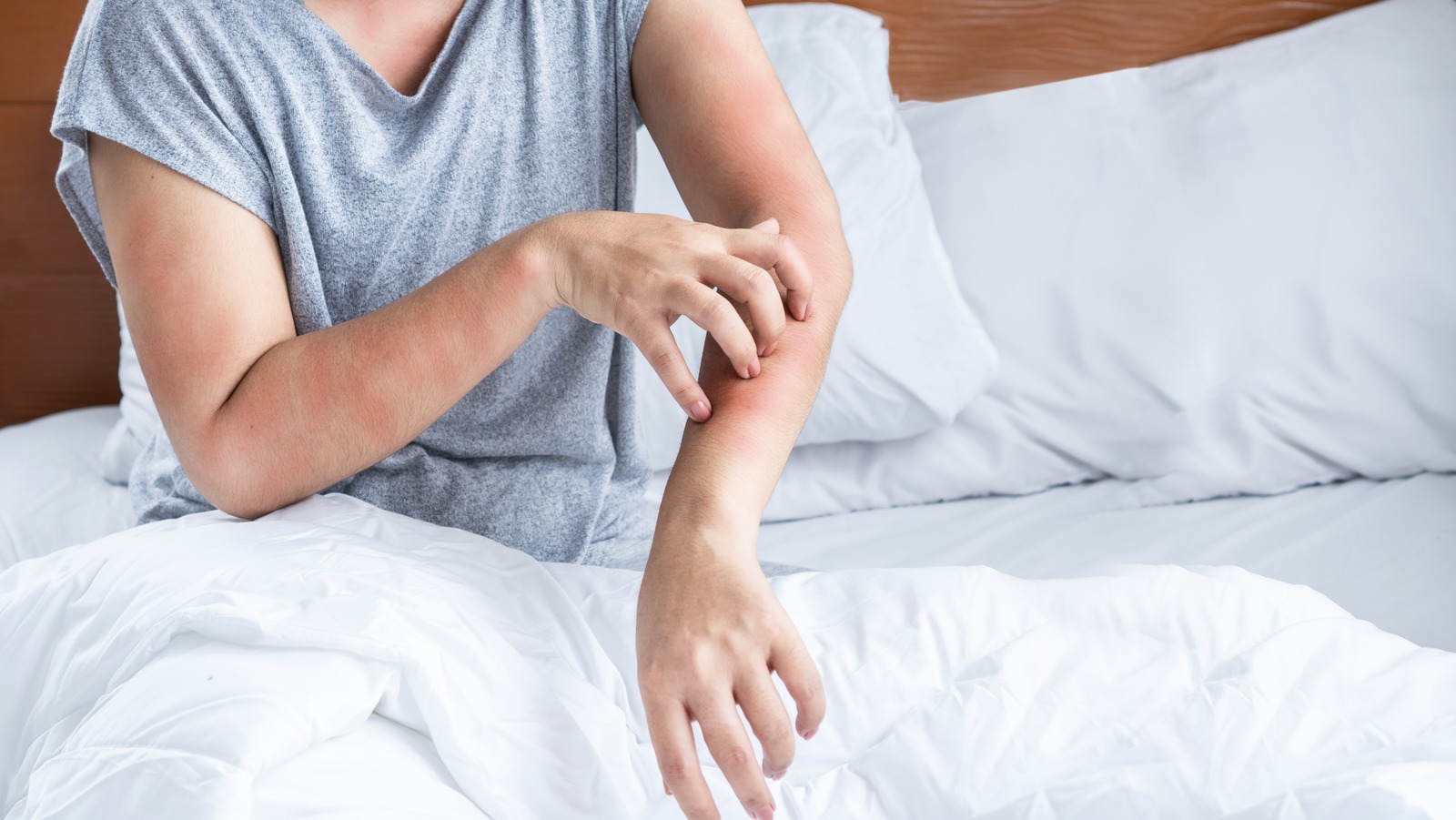 Can You Kill Bed Bugs With Hydrogen Peroxide? Think Twice Before You Try