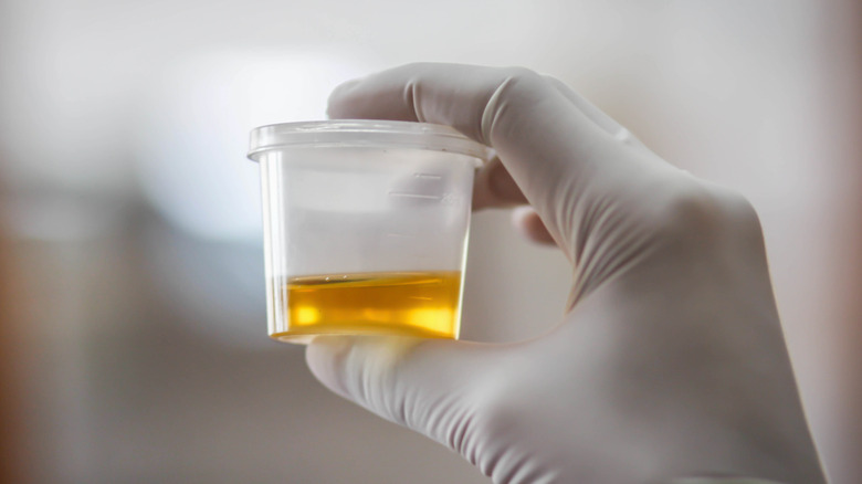 A gloved hand holding a urine sample