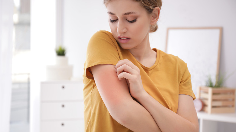 woman with rashes