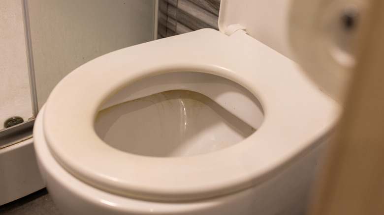 Dirty rim of toilet bowl