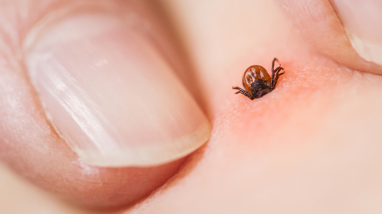 Tick biting a person's skin