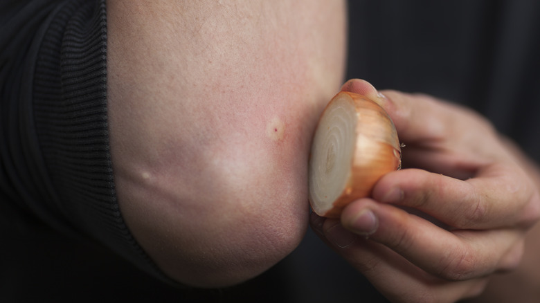Applying onion to bee sting