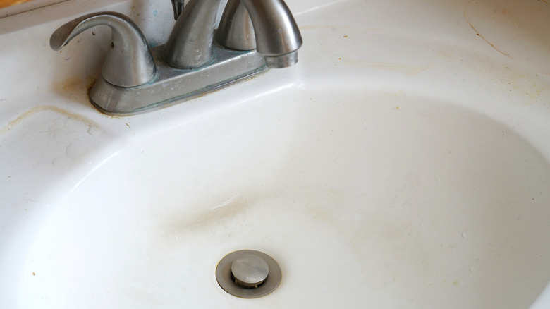 A close-up shot of a dirty bathroom sink
